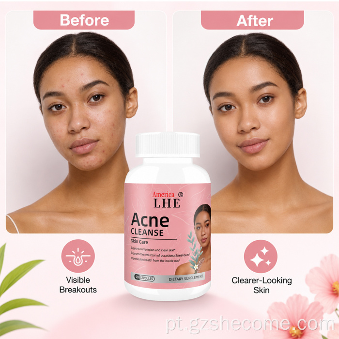 Shecome Acne Capsules Suporte para pele clara
